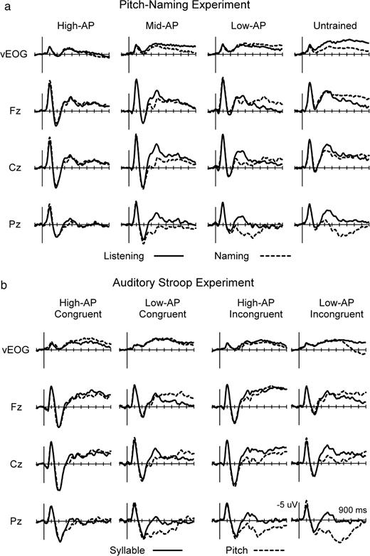Group averaged ERPs in pitch-naming experiment (a) and auditory Stroop experiment (b). The baseline condition (solid) was to listen to simple tones (pitch-naming experiment) or to repeat syllables of auditory Stroop stimuli (auditory Stroop experiment). Overt naming of pitches (dotted) in both experiments significantly affected the ERPs in a manner dependent on AP ability, revealing the ERP correlates of RP (Fig. 3). See Figure 4 for the locations of electrodes on the scalp.