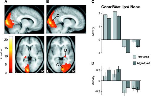 SPMs of brain areas activated by unilateral contralateral visual stimuli (threshold P < 0.0001). (A) Responses to RVF checkerboards greater than LVF checkerboards in left occipital cortex and left lateral geniculate nucleus. (B) Responses to LVF greater than RVF checkerboards in right occipital cortex and right lateral geniculate nucleus, whose activity across conditions is plotted in (C) and (D), respectively. (C) Average parameter estimates of activity (±SE) in the right occipital cluster (544 2 × 2 × 2 mm3 voxels, mean x y z = 13 −96 7) for all conditions of peripheral visual stimulation and central attentional load, showing preferential responses in presence of contralateral stimulation (i.e. for contralateral-unilateral and also bilateral checkerboards), but decreased activation with higher attentional load for the central task. Left occipital regions showed a similar pattern. (D) Average parameter estimates of activity (±SE) in the right lateral geniculate nucleus cluster (82 2 × 2 × 2 mm3 voxels, mean x y z = 24 −26 −6) for all conditions, showing preferential responses in presence of contralateral stimulation (i.e. for contralateral-unilateral and bilateral stimulation), but no significant decrease during higher central attentional load. The left geniculate showed a similar pattern. Same abbreviations as in Figure 2.