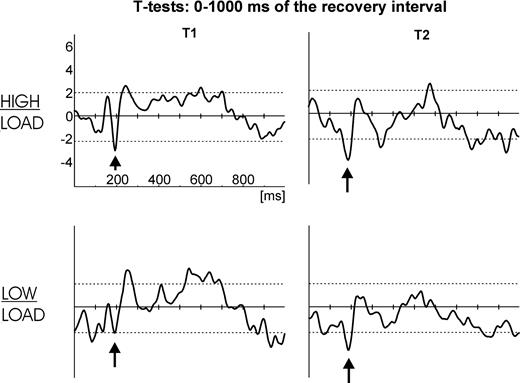 Sample by sample t-tests for the comparison: without interference versus with interference, separately for high load (top row) and low load (bottom row). Dotted horizontal lines indicate the 95% α-significance level (two-sided). A left frontal electrode (T1) is shown on the left and a right frontal electrode (T2) is shown on the right. Black arrows denote the negative t-test values at frontal sites that reflect an earlier, hence stronger positive ERP component at the time of the peak in the condition with interference (as in Figure 5).