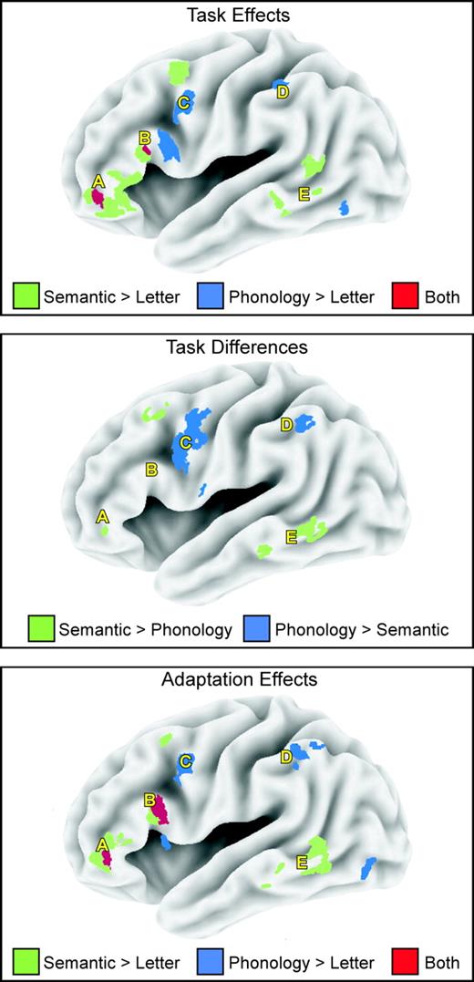 Task and adaptation effects at the whole-brain level. Maps plot z-values from a voxel-based, mixed effects analysis (P < 0.001), with subjects treated as a random effect. Maps are projected onto a semi-inflated surface of the lateral left hemisphere. Regions exhibiting activations preferential for controlled semantics (green), controlled phonology (blue) and common to both controlled semantic and phonological tasks (red) are displayed. The top panel (Task Effects) displays significant activations for controlled semantic and phonological tasks, compared with the letter task, under novel processing conditions. aLIPC (A; ∼ BA 45/47) and pLIPC (B; ∼ BA 44) regions showed overlapping activation patterns, with the most anatomically extensive activation for the semantic task. A region in left posterior frontal cortex (C; ∼ BA 6) and a region in left parietal cortex (D; ∼ BA 40) showed significant activation for phonological processing, whereas posterior temporal cortex (E; ∼ BA 21) showed significant activation for semantic processing. The middle panel (Task Differences) displays results from a direct comparison of semantic and phonological tasks, under novel processing conditions. A small region in aLIPC (A; ∼ BA 45/47) and a region in left posterior temporal cortex (E; ∼ BA 21) showed significantly greater activation during controlled semantic processing than controlled phonological processing. A posterior left frontal region (C; ∼ BA 6) and a region in left parietal cortex (D; ∼ BA 40) showed significantly greater activation for controlled phonological processing than controlled semantic processing. The bottom panel (Adaptation Effects) displays significant adaptation effects associated with semantic and phonological tasks, compared with the letter task. aLIPC (A; ∼ BA 45/47) and pLIPC (B; ∼ BA 44) regions showed overlapping adaptation effects associated with semantic and phonological tasks, with the most anatomically extensive adaptation effects for the semantic task. A posterior left frontal region (C; ∼ BA 6) and a left parietal region (D; ∼ BA 40) showed significant adaptation associated with repeated phonological processing, whereas posterior left temporal cortex (E; ∼ BA 21) showed adaptation for the semantic task. (See text for description of activations in other regions displayed in the figure).