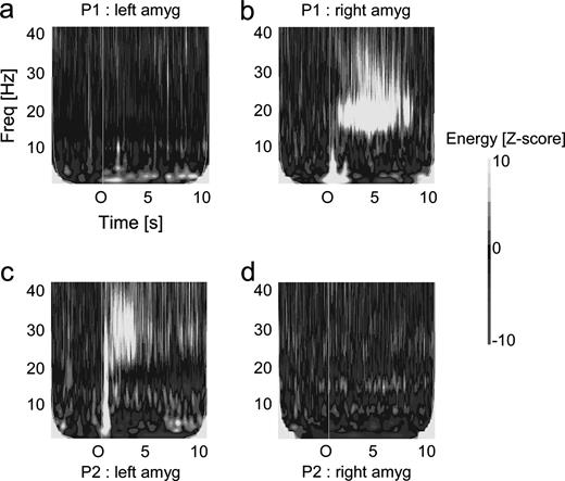Lateralization of the amygdalar oscillations induced by the odorants in the two patients with a bilateral implantation of the amygdala. Top: responses in a patient with a right nostril stimulation. (a) Response in the left amygdala. (b) Response in the right amygdala. Bottom: same for a patient with a left nostril stimulation. (a) Response in the left amygdala. (b) Response in the right amygdala.