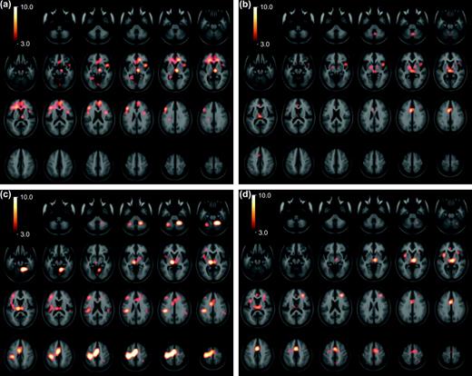 Coactivation patterns of striatal nucleii. Statistical peaks (in hot-metal color) of brain areas coactivated with the left caudate (a), right caudate (b), left putamen (c), and right putamen (d) superimposed upon the ICBM152 MRI (see text for details). Color bar indicates degree of statistical significance (t statistic). Axial sections are spaced 5 mm apart, and start at z = −50. Note that on these images the left hemisphere is on the left.