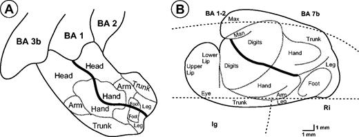 Human Parietal Operculum. I. Cytoarchitectonic Mapping of Subdivisions ...