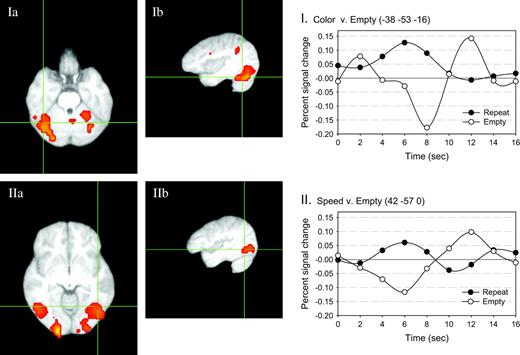 Areas of overlap between the color and motion tasks. The activity associated with the repeat trials of each task were found, and then areas of overlap between the two activation maps were assessed. Two areas are shown. Panels Ia and Ib (axial and sagittal views, respectively) show activity in the same fusiform area that previous studies have shown to be associated with color processing. The estimated impulse response function associated with processing repeat and empty target stimuli are plotted at the right (I). Panels IIa and IIb (axial and sagittal views, respectively) show activity in a more dorsal and lateral area, that has been previously shown to be associated with motion processing. The estimated impulse response function associated with processing repeat and empty target stimuli are plotted at the right (II).