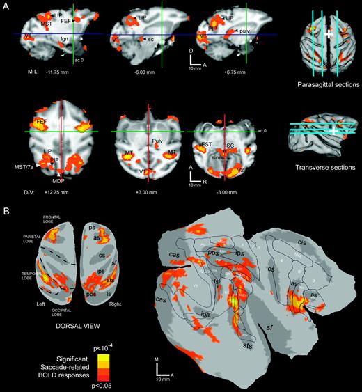 Saccade-related activations in the monkey. Brain sites significantly active (P < 0.05) during the saccade task are color-labeled (see color scale) and superimposed over (A) parasagittal (first row) and transverse (second row) cross-sections and (B) cortical surface renderings. In (A), slice positions are shown over dorsal and lateral view renderings of the cortical surface. Perpendicular lines (cross-sections) and white cross hairs (surface views) indicate the position of the anterior commissure. In (B), the same data set is shown after projection to the cortical surface of subject M1. See text for details.