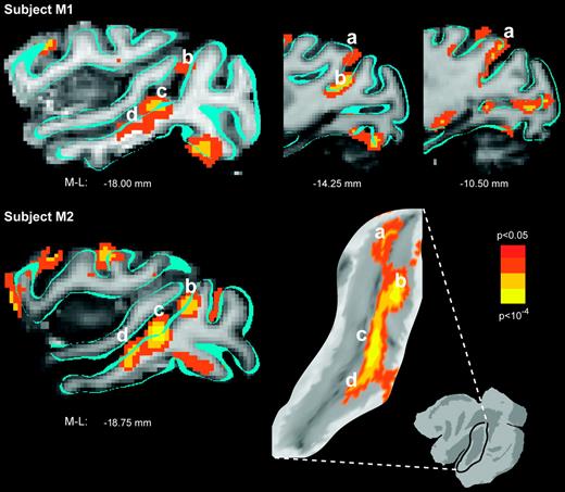 Temporal cortex summary. Superior temporal activation (P < 0.05) from each subject (M1, first row; M2, second row) is color-coded for statistical significance and superimposed on the corresponding anatomical images from that subject. Parasagittal cross-sections show the activation pattern that was characteristically observed along the superior temporal sulcus, including a caudal anterior bank site (a) and several additional sites on the posterior bank and fundus (b–d). For subject M2, results are also shown projected and superimposed onto a cropped, flattened portion of the left superior temporal sulcus for reference.