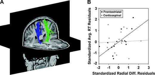 Reaction times are not correlated with radial diffusivities in the corticospinal tract after accounting for association with frontostriatal radial diffusivities. (A) Left (green) and right (blue) corticospinal fiber tracts superimposed on axial and coronal T1-weighted anatomical images for a typical subject. (B) Frontostriatal radial diffusivity (λ⊥) predicted average reaction times independent of corticospinal radial diffusivity, but not vice versa. In black, standardized residuals after regressing average reaction time on corticospinal λ⊥ were plotted against standardized residuals after regressing frontostriatal λ⊥ on corticospinal λ⊥, yielding a visual representation of the partial correlation of frontostriatal λ⊥ and average RT after controlling for corticospinal λ⊥ (r = 0.66, P < 0.014). In contrast, corticospinal λ⊥ did not predict average RT after controlling for associations with frontostriatal λ⊥ (grey data points: r = 0.05, P = 0.878) and was not associated with RT adjustments or speed matched accuracies (not shown).