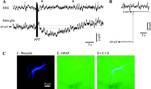 Hyperpolarizing responses in astrocytes after PPT activation. (A) Intraglial (microelectrode filled with biocytin) and EEG recording from a cat under ketamine–xylazine anesthesia. The intracellular recording was performed in area 5 and the EEG electrode (screw in the bone) was placed just anterior to the intracellular pipette. The stimulation of the PPT nucleus (100 stimuli at 100 Hz) elicited a prolonged hyperpolarization. (B) At the end of the recording, the intracellular electrode was withdrawn from the glia for verification of the real Vm. (C) Anatomical verification of the glia recorded in (A) and (B). Panel 1 displays the shape of an astrocyte, panel 2 the same cell verified for reactivity to GFAP and panel 3 contains the superimposition of the previous two panels. In this and all subsequent figures potentials are presented with positivity upwards.