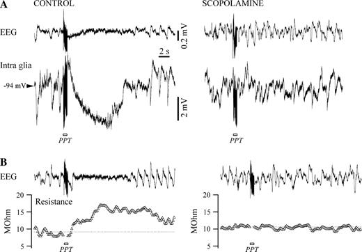 Muscarinic antagonist scopolamine abolishes Vm hyperpolarization and input resistance increase in glia. (A) Control recording in a glia before (left) and after (right) systemic application of scopolamine (0.5 mg/kg). The hyperpolarization elicited with PPT stimulation under control conditions disappears after blockage of muscarinic receptors. (B) Input resistance modification in the same glia in control conditions (left) is canceled after scopolamine application (right).