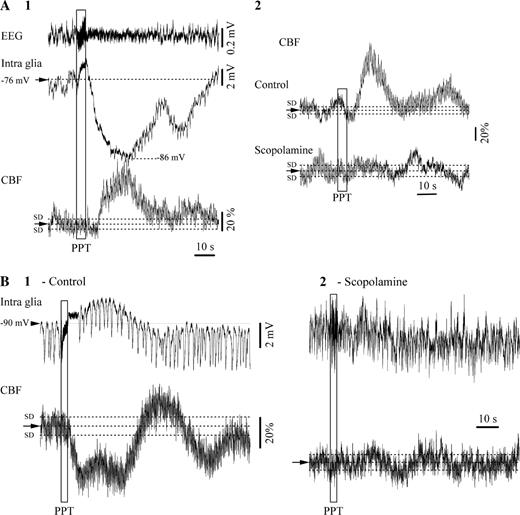 Cerebral blood flow (CBF) in association with glial responses to PPT cerebral activation. (A1) Hyperpolarizing responses were always associated with transient increases of the CBF. (A2) These responses were abolished by the muscarinic antagonist scopolamine. (B1) Glial depolarization after PPT stimulation was always associated with decreased CBF, and this effect was antagonized by scopolamine (B2).