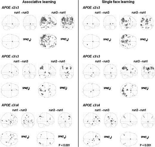 Brain activity differences between learning runs 1 and 3 per APOE group. Displayed are sagittal, coronal, and horizontal SPM2 through projections of brain regions that exhibited a significant signal decrease (run 1–run 3) or signal increase (run 3–run 1) during associative learning (left side) and single-face learning (right side).