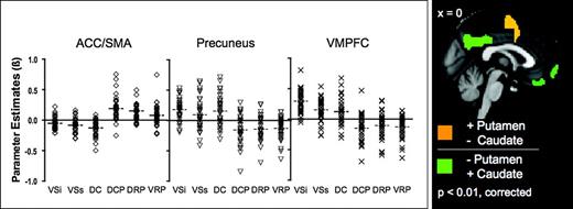 Brain regions correlated with both putamen and caudate but in opposite directions. On the left panel the scatter plots represent the mean parameter estimates (regression coefficients) of striatal seed connectivity (VSi, VSs, DC, DCP, DRP, and VRP, from left to right, respectively) with ACC/supplementary motor area (SMA), precuneus, and with ventromedial prefrontal cortex (VMPFC), from the left to right, respectively. Outlier β values not included in the scatter plot were as follow: β = 1.07 and −1.30 for DRP connectivity with ACC/SMA and precuneus, respectively; β = −1.11 for DCP connectivity with VMPFC. On the right panel the brain regions exhibiting positive correlations with the putamen seeds (i.e., DCP + DRP + VRP) but negative correlation with caudate seeds (i.e., VSi + VSs + DC) and vice versa (orange and green, respectively) are shown.