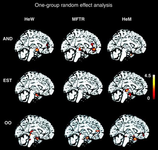 Illustration of group-specific activations with the putative pheromones and odors. The Sokoloff’s color scale illustrates Z values reflecting the degree of activation. As the same brain section is chosen, the figures do not always illustrate maximal activation for each condition. Clusters of activated regions are superimposed on the standard brain MRI, midsagittal plane. The cingulate cluster in HeW and the left amygdala + piriform cluster in HeM for AND were not significant. Neither were the midbrain clusters in the bottom row.