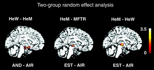 Significant differences between the groups. Shown are the clusters calculated with 2-group random effect analysis, superimposed on standard brain MRI. The Sokoloff’s color scale illustrates Z values reflecting the degree of activation. The cingulate cluster in HeW and the left amygdala + piriform cluster in HeM for AND were not significant.