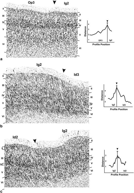 Borders between Ig2 and opercular area OP3 (a), Ig2 and an adjacent more dorsal dysgranular insular area Id3 (b), as well as Ig2 and an adjacent more ventral dysgranular insular area Id2 (c). (a) The border between Ig2 and OP3 is characterized by larger and more numerous pyramidal cells in layer V of Ig2. (b) The border between Ig2 and Id3 is demarcated by a decrease of cortical thickness and a decrease of layer IV in the dysgranular area Id3. (c) The border between Ig2 and Id2 is characterized by a decrease of cell density in layer III and a less conspicuous layer IV in Id2.
