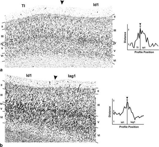 Borders between Id1 and the temporoinsular region TI (a) as well as Id1 and the agranular insular area Iag1 (b). (a) TI differs from Id1 by a higher cell density in layer III of TI. (b) The border between Id1 and Iag1 is characterized by a loss of layer IV and a lower cell density in layer II of Iag1.