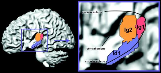MPM of the posterior insula indicating for each voxel the most likely area. For better visualization, temporal lobe and cortex were removed. The opercular lobe, however, remained.