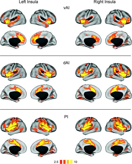 Functional connectivity (t-maps) of insular subregions: ventral anterior insula (vAI), dorsal anterior insula (dAI), and posterior insula (PI). Connectivity maps for left hemisphere seeds are shown on the left; maps for right hemisphere seeds are on the right.