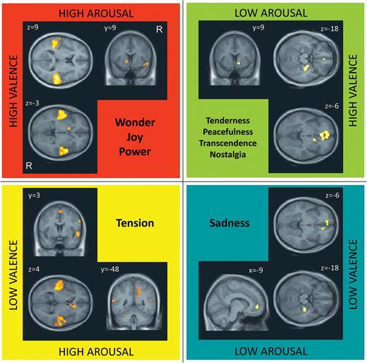 Brain activations corresponding to dimensions of Arousal–Valence across all emotions. Main effects of emotions in each of the 4 quadrants that were defined by the 2 factors of Arousal and Valence. P ≤ 0.05, FWE corrected.