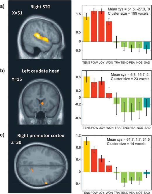 Differential effects of emotion categories associated with high arousal. Parameter estimates of activity (beta values and arbitrary units) are shown for significant clusters (P < 0.001) in (a) right STG correlating with the main effect of emotions in the A+V+ quadrant, (b) right caudate head, and (c) right premotor cortex correlating with the main effect of Tension in the A+V− quadrant (A+V−). The average parameters of activity (beta values and arbitrary units) are shown for each of these clusters. Error bars indicate the standard deviation across participants.