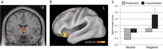Sustained responses that increase as a function of greater task-evoked anxiety. (A) The right VBF/BNST, left (B) and right insula increased in sustained activity with greater task-evoked anxiety. Image threshold P < 0.05, whole-brain corrected. (C) Mean signal estimates in right IFG/insula (x = 33, y = 29, z = −12) plotted for the 4 sustained conditions. Error bars denote standard error of the mean.