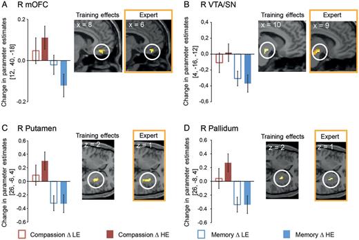 Effects of compassion and memory training on neural responses to HE videos. The contrast [Compassion ΔHE > Memory ΔHE] revealed activations (P < 0.05; SVC) in (A) the right mOFC, (B) the right VTA/SN, (C) the right pallidum, and (D) the right putamen. Bar charts show the change in parameter estimates in the depicted independent region of interest; error bars denote the SEM. Orange boxes show neural activations (P < 0.05; FWE-corrected) of an expert practitioner immersed in 3 compassionate states [high > low degree] across 15 sessions depicted within independent ROIs. Color-coded activations with brighter colors indicating lower P-values were rendered on an MNI template in neurological orientation. Inset x/z values indicate a stereotactic coordinate of the shown slice in the MNI space.