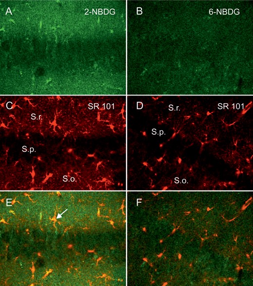 Multiphoton images of hippocampal brain slices (p 18) incubated in different glucose analogs as indicated, for 1 h and subsequent wash-out for 1 h (A and B), the same slice regions were stained with Sulforhodamine 101 (SR101) for astrocyte identification (C and D), with indication of the different layers, Stratum radiatum (S.r.), Stratum pyramidale (S.p.), and Stratum oriens (S.o.). The images of (A–D) were superimposed (E and F), showing colocalization of astrocytes and staining pattern of the glucose analog.