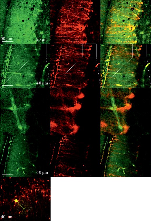 Multiphoton images of cerebellar brain slices incubated in 2-NBDG for 1 h and washed-out for 1 h at different tissue depths between 20 and 60 µm (left). Images of the same slices at the same depth, respectively, of astrocyte-specific labeling of GFRT mice, showing primarily Bergmann glial cells (middle) and the superimposed images (right), indicating colocalization of 2-NBDG fluorescence and mRFP1 staining. The lower left image shows a slice image with a single Purkinje cell loaded with 2-NBDG (yellow) and labeled astrocytes (red) in the GFRT mouse.