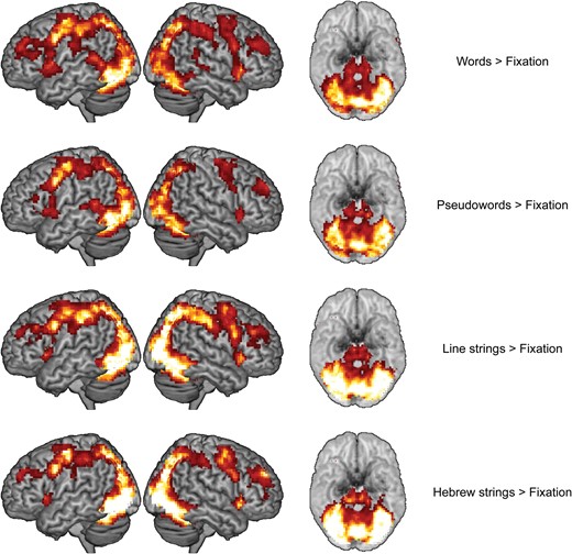 Surface rendering of the baseline contrasts (left, right, and ventral views with the cerebellum removed, respectively).