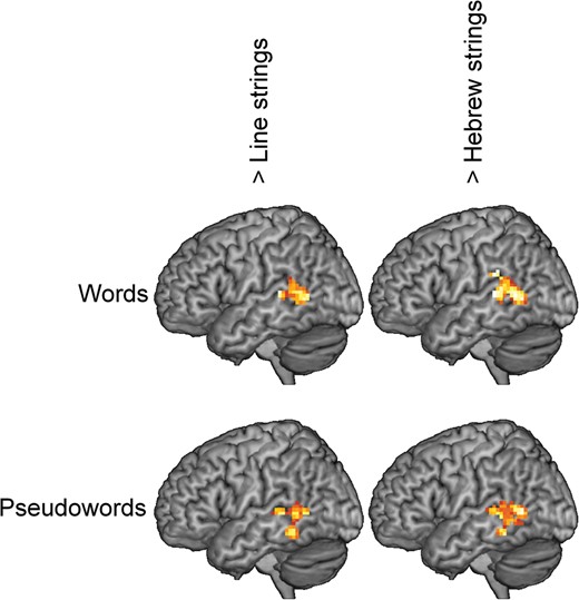 Surface rendering of the differences between stimulus types.