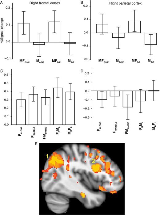 Region-of-interest analysis: (A–D) Percentage blood oxygen-level-dependent signal changes for each condition relative to the rest baseline condition. Error bars are the 95% confidence intervals. Study 1 is depicted in Panels (A) and (B); Study 2 is depicted in Panels C and D. (A) and (C) The results from the ROIs in the right middle frontal gyrus (MFG) and (B) and (D) from the ROIs in the right supramarginal gyrus (SMG). Conditions labeled as in the text, but with the following abbreviations: MFD/NP = (MFDIOTIC/NON-PREDICTABLE); MA/NP = (MALONE/NON-PREDICTABLE); MFD/P = (MFDIOTIC/PREDICTABLE); MFA/P = (MFALONE/PREDICTABLE), L = left; R = right. (E). A sagittal view of the right hemisphere, at X coordinate = 42 mm. The contrast of diotic with single speaking conditions was directly compared in whole-brain analyses between Studies 1 and 2. Predictably, from the profile of activities observed in the ROI analyses, both right frontal (labeled 2) and parietal cortices (labeled 1) were more “active” in Study 1. However, this disguises the dissociation of responses between frontal and parietal cortices: The loss of “contrast” in Study 2 was due to an increase in activity in response to a single speaker in frontal cortex, but a decline in activity in response to diotic listening in parietal cortex.