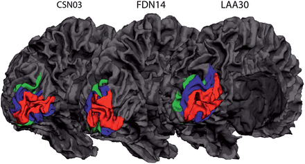 Variability in cortical surface size of early visual areas. Representative maps of 3 participants showing cortical regions V1–V3 on a reconstructed 3D mesh of the left hemisphere. Red indicates V1, blue indicates V2, and green indicates V3.