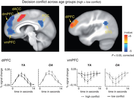 fMRI results across groups. “Upper panel”: Significant effects of decision conflict (t-statistics). Positive activations (shown in red) reflect greater activity in the high than the low conflict condition. We found greater activity for high conflict options in areas associated with cognitive control, such as the right dlPFC and the bilateral ACC. Deactivations (shown in blue) for high than low conflict options were observed in the dorso- and ventromedial PFC, the PCC, and the bilateral superior temporal gyrus. “Lower panel”: Time courses for activity in the dlPFC and vmPFC areas, shown separately for high (dashed lines) and low (solid lines) conflict conditions and the 2 age groups. Younger adults are shown in black, older adults are shown in gray. Error bars reflect the standard error of the mean (SE). The onset of the time course refers to the onset of the decision options.