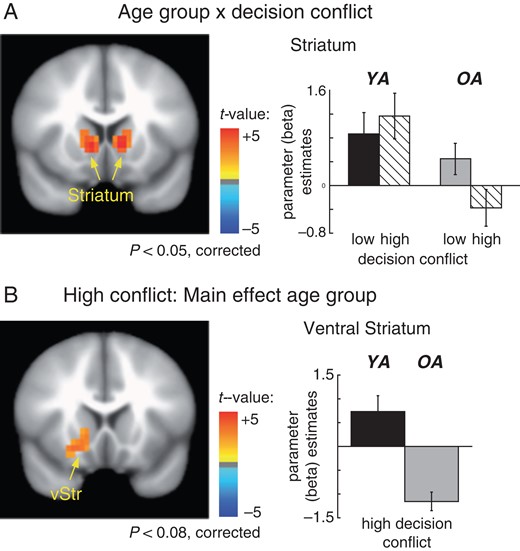 (A) Age group × conflict interaction in the striatum. Older adults (gray bar graphs) show a significant deactivation for high compared to low conflict options in the bilateral dorsal striatum. No such effect is observed in younger adults (black bar graphs). Error bars reflect the standard error of the mean (SE). (B) Separate analyses for the 2 decision conflict conditions showed hypoactivation in the ventral striatum for older compared to younger adults in the high conflict condition. No significant age differences were observed in the low conflict condition. Note that the bargraphs were determined using functional ROIs.