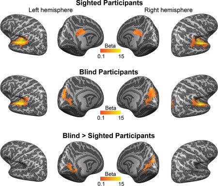 Functional activation in response to long-duration, sustained sounds. The first and second rows show the mean regression weights—that is, the average beta map—resulting from the within-group RFX GLM (contrast sustained + transient > baseline) projected on the group-averaged cortical surface. The third row shows the result of a mixed effects model testing for group differences in functional activation between blind and sighted participants. All maps were thresholded with a nonparametric permutation testing procedure at P < 0.05 and corrected for multiple comparisons with a local clusterwise inference (final threshold P < 0.05; see Methods).