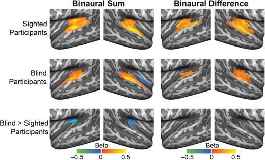Univariate analysis of the processing of spatialized sounds in the AC. Mean beta maps resulting from within-group RFX GLMs for sighted and blind participants (upper 2 rows). The left column shows maps for the general auditory response independent of sound location (binaural sum > baseline); and the right column, for the location-specific response (binaural difference > baseline). The bottom row displays the beta weight map resulting from a mixed effects model testing for group differences in functional activation between blind and sighted participants. All maps were thresholded with a nonparametric permutation testing procedure at P < 0.05 and corrected for multiple comparisons with a local clusterwise inference (final threshold P < 0.05; see Methods).