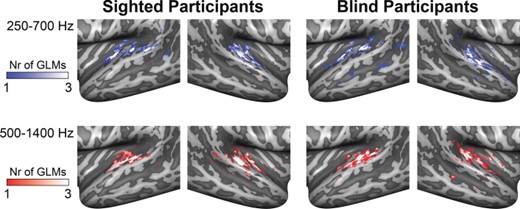 Vertices in the AC modulated by binaural spatial cues. Maps show the results of the 3 within-group RFX GLMs estimated with the binaural sum and binaural difference predictors for the contrast binaural difference > baseline in sighted participants (left column) and blind participants (right column). Each GLM was estimated on the data of 2 sound intensity conditions. For each GLM, we color-coded the 1000 vertices in each hemisphere with the highest regression weight for the abovementioned contrast. Whiter colors indicate that a vertex was identified as spatially sensitive by multiple GLMs. Top row shows results for stimuli in the condition of 250–700 Hz; bottom row shows the results for stimuli in the condition of 500–1400 Hz. All vertices responded maximally to contralateral sound locations. Nr = number.