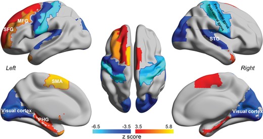 The results of the comparison of Σ between schizophrenia patients and healthy controls. This figure shows the AAL2 areas with significant differences after FDR correction (P < 0.05). Normalization of Σ was used across participants, applied in the same way as for the effective connectivity. Red–yellow indicates AAL2 regions with increased Σ, and blue with decreased Σ, in patients with schizophrenia (see Table 2).