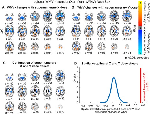 Local WMV changes as a function of X- and Y-chromosome dosage. (A, B) Thresholded t-maps, where colored regions represent cortical and subcortical tracts showing statistically significant WMV changes with (A) increasing supernumerary X-chromosome dosage, or (B) increasing supernumerary Y-chromosome dosage (P < 0.05 for all tracts after correction for multiple comparisons; blue represents areas where WMV decreases as chromosome dosage increases, and orange represents areas where WMV increases as chromosome dosage increases). (C) Conjunction t-map showing the high degree of overlap between areas where X-chromosome dosage affects WMV and areas where Y-chromosome dosage affects WMV (blue represents regions where WMV decreases with both mounting X- and mounting Y-chromosome dosage, and orange represents regions where WMV increases with both mounting X- and mounting Y-chromosome dosage). (D) Density plot demonstrating that the observed cross-voxel correlation between X- and Y-chromosome effects on local WMV is greater than 1000 correlations generated by randomly permuting SCA labels across participants.