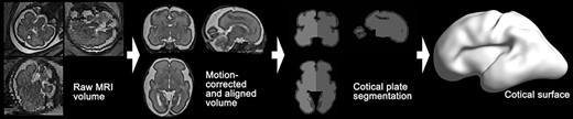Overview of fetal brain MRI processing pipeline for cortical surface reconstruction. Raw MRI volume of fetal brain is processed for motion-correction and spatial alignment. Left and right cortical plate regions are segmented, and then cortical surface is extracted.