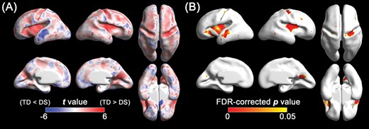 Statistical results of the vertex-wise comparison in sulcal depth between DS and TD fetuses using the linear mixed models. (A) Statistical t map. Red indicates sulcal depth in fetuses with DS is shallower than TD fetuses, and blue indicates sulcal depth in fetuses with DS is deeper than TD fetuses. (B) FDR-corrected p map. Red represents regions showing statistically different sulcal depth between DS and TD groups (FDR-corrected P < 0.05).