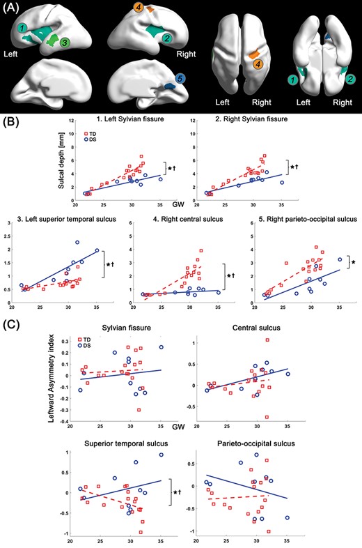 Clustered regions showing significant group difference in sulcal depth, and age-related trajectories of sulcal depth and leftward asymmetry index in the regions. (A) Clustered regions under 0.05 of FDR-corrected P value in group comparison. The clusters belong to 1) left Sylvian fissure, 2) right Sylvian fissure, 3) left superior temporal sulcus, 4) right central sulcus, and 5) right parieto-occipital sulcus. (B) Growth trajectories of average sulcal depth and their group difference in each cluster. (C) Age-related changes of leftward asymmetry index and their group difference in each cluster. x-axis indicates GW, and y-axis indicates observed values of sulcal depth (mm) and leftward asymmetry index. *Significant group difference and †significant group-GW interaction effect.
