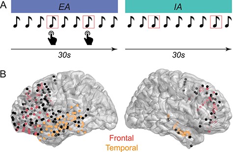 Experimental task and electrode locations. A) Subjects performed a target detection task, in which they were instructed to direct their attention externally (EA) and respond to target tones (shown in red square outline), or direct their attention internally (IA) toward their own thoughts and ignore the tones. B) Implanted electrodes across all subjects in the lateral frontal and temporal cortices shown on a Montreal Neurological Institute template brain, in lateral perspectives. Responsive electrodes included in the analyses in the frontal cortex are shown in red. Responsive electrodes included in the analyses in the temporal cortex are shown in orange. Electrodes shown in black were nonresponsive electrodes that were excluded from analyses (as described in Methods). The saturation of electrode colors reflects the location of electrodes along the gyrus (brighter) and sulcus (less bright) surfaces.