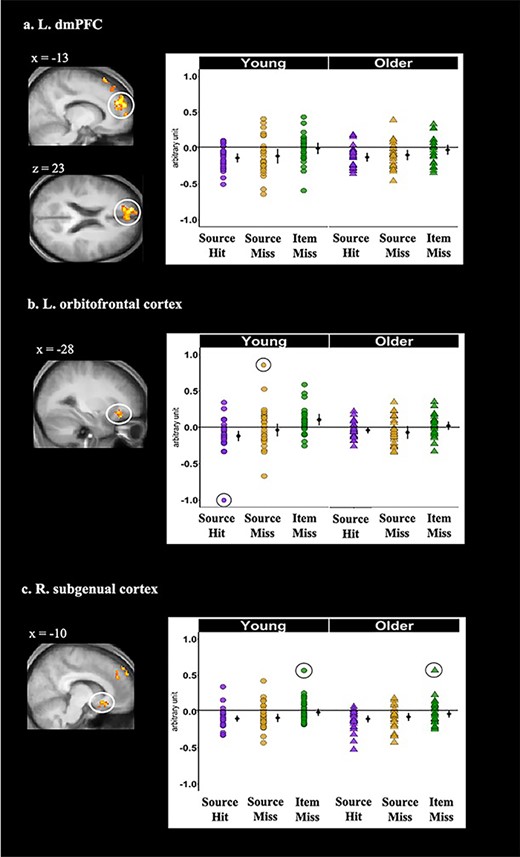 Cortical regions identified by the whole-brain analyses that demonstrated significant age-invariant main effects of memory condition during the prestimulus period: (a) left dmPFC, (b) left orbitofrontal cortex, and (c) right subgenual cortex. Shown on the left side of each panel are the significant clusters, marked by circles, overlaid on the across-participants mean T1-weighted structural image. Parameter estimates of prestimulus activity for each region are plotted on the right side of each panel. Individual parameter estimates (arbitrary units) are plotted separately for young (circles) and older adults (triangles) as a function of subsequent memory. The black dots represent the group means and the bars signify 95% confidence intervals. The confidence intervals were computed excluding the flagged outliers (list-wise exclusion).