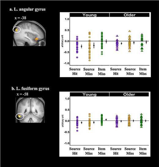 Cortical regions identified by the whole-brain analyses that demonstrated significant age-dependent main effects of memory condition during the prestimulus period: (a) left angular gyrus and (b) left fusiform gyrus. Shown on the left side of each panel are the significant clusters, marked by circles, overlaid on the across-participants mean T1-weighted structural. Parameter estimates of prestimulus activity for each region are plotted on the right side of each panel. Individual parameter estimates (arbitrary units) are plotted separately for young (circles) and older adults (triangles) as a function of subsequent memory. The black dots represent the group means and the bars signify 95% confidence intervals. The confidence intervals were computed excluding the flagged outliers (list-wise exclusion).