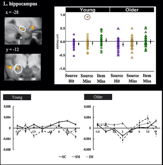 Hippocampal cluster (indicated by the circle) identified by small volume correction that demonstrated a significant prestimulus SMEs. The left panel shows the significant cluster overlaid on the across-participants mean T1-weighted structural. The right panel plots the parameter estimates of prestimulus activity as a function of age group and subsequent memory. Individual parameter estimates (arbitrary units) are plotted separately for young (circles) and older adults (triangles) as a function of subsequent memory. The black dots represent the group means and the bars signify 95% confidence intervals. The confidence intervals were computed excluding the flagged outliers (circles). The lower panel illustrates the time-courses of the prestimulus subsequent memory effects for young (left panel) and older (right panel) adults in the left hippocampus. Signal amplitude is in arbitrary units. Time (in seconds) is plotted on the x axis, with time 0, marked by the arrows, indicating onset of the task cue.