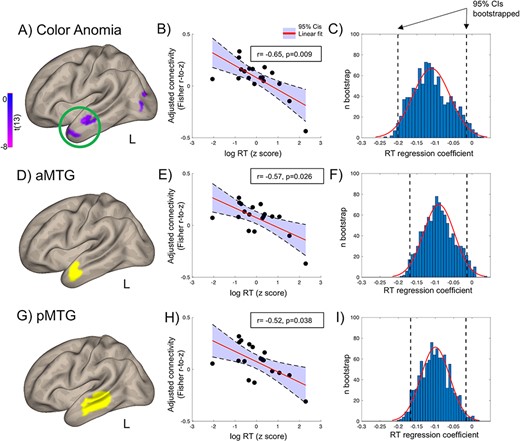 ROI analysis. Color naming RTs correlated with the left PC connectivity (bivariate correlations, adjusted for participants’ age and gender) with: (A–C) brain regions disconnected from color-sensitive cortex in a color anomic patient (green circle in A, Siuda-Krzywicka et al. 2019b); (D–F) the left anterior MTG; (E–I) the left anterior MTG. Boxes in (B,E,H) depict partial correlation coefficients of RTs correlated with PC–ROI connectivity, controlling for age and gender. (C,F,I) Bootstrapped regression estimates. RT effects in all 3 ROIs were significant with bootstrapping, note 95% confidence intervals limits below 0. The anatomical ROIs come from the Harvard–Oxford Atlas (Desikan et al. 2006).