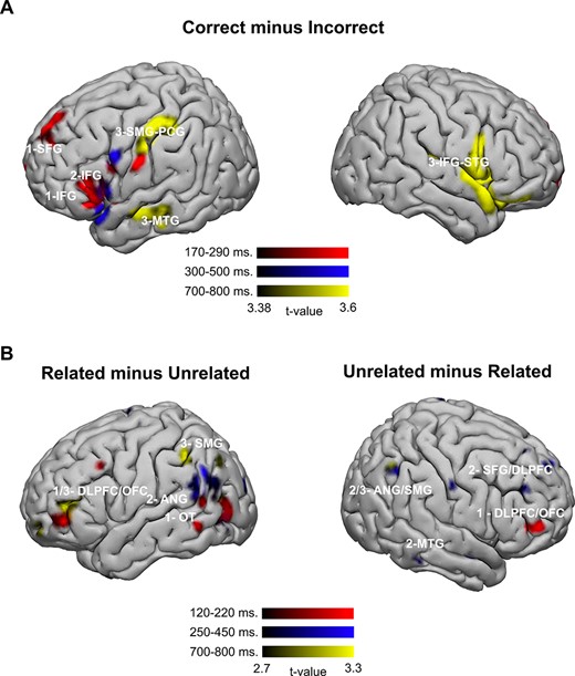 Results at the source space. (A) Correct–incorrect contrast (source amplitudes that were larger for correct than for incorrect solutions). (B) Related–unrelated contrast. Source amplitudes that were larger for the related solutions are on the left (a left-lateralized network) and source amplitudes that were larger for the unrelated solutions are on the right (a right lateralized network). OT: occipitotemporal.