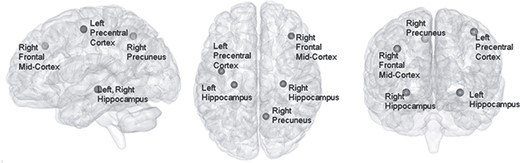 The Alzheimer’s disease activation map shown on a smoothed MNI 152 template. This image is shown by BrainNetViewer (Xia et al. 2013).