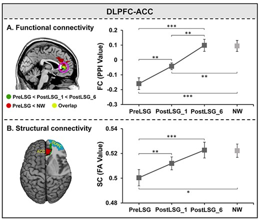 Repeated measure ANOVAs for FC and SC between DLPFC and ACC. (A) Post hoc tests showed significant sustained increases in FC between DLPFC and pgACC at PostLSG_1 and PostLSG_6, and FC was equivalent to that in NW at PostLSG_6. (B) Post hoc tests showed significant sustained increases in SC between the right DLPFC and ACC at both PostLSG_1 and PostLSG_6, and SC was equivalent to that in NW at PostLSG_6. Notes: DLPFC, dorsolateral prefrontal cortex; ACC, anterior cingulate cortex, NW, normal weight; HiCal, high-calorie; PreLSG, obese patients who received MRI scan before surgery; PostLSG_1, obese patients who received MRI scan at 1 month after surgery; PostLSG_6, obese patients who received MRI scan at 6 month after surgery; PPI, psychophysiological interaction; FA, fractional anisotropy.
